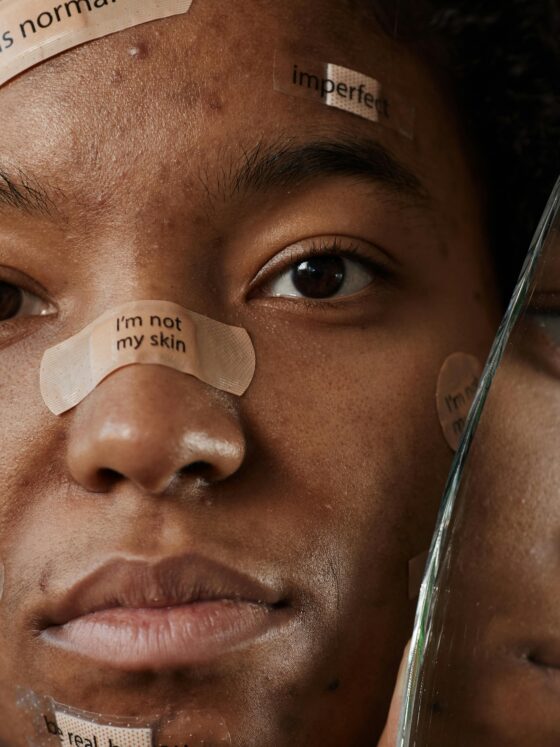 Radical self acceptance